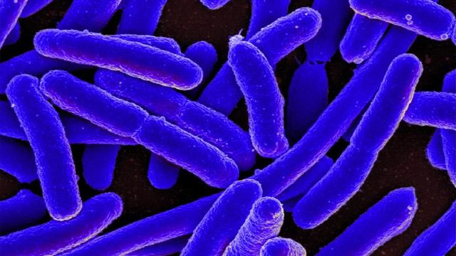 Lab-on-a-Chip for Bacterial Shape Sorting