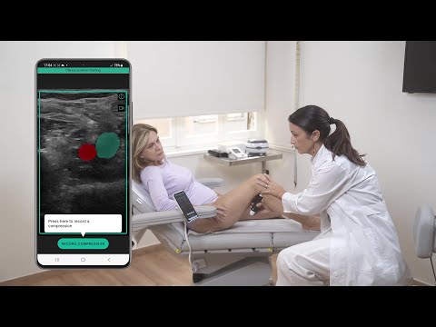 Clarius Marketplace Unlocks the Power of AI Innovation for Ultrasound Imaging